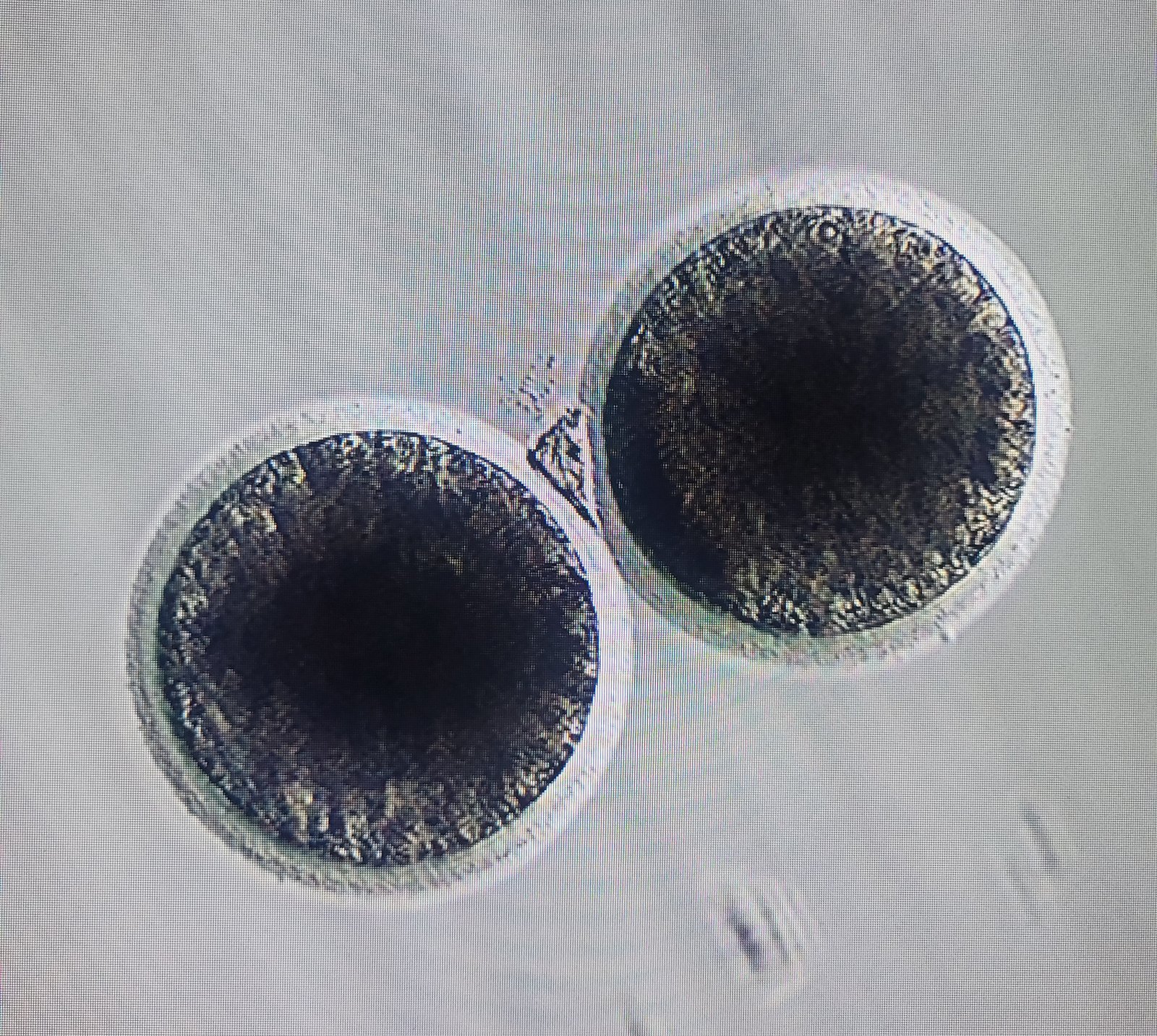 Embryo Storage