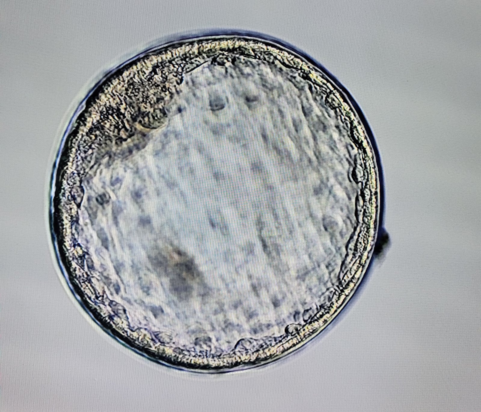 Embryo Vitrification
