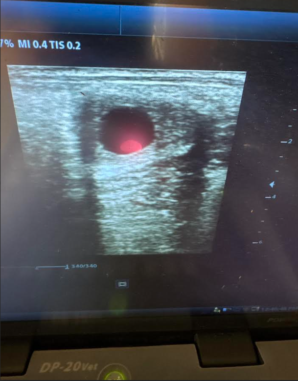 VNRC Embryo Positive Pregnancy Scan